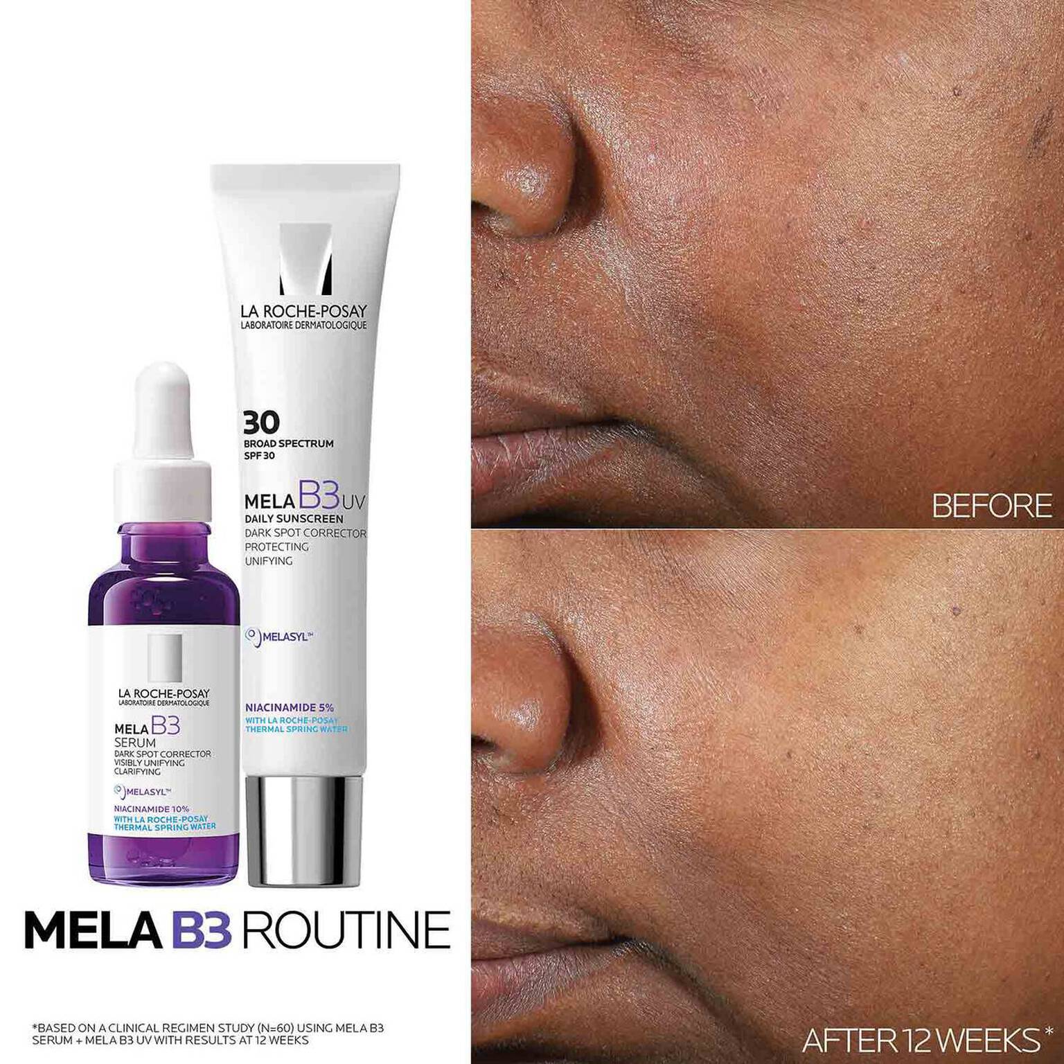 mela-b3-dark-spot-serum-and-mela-b3-uv-daily-moisturizer-with-spf-30-w6 3-Mela-B3-routine_1500X1500.jpg