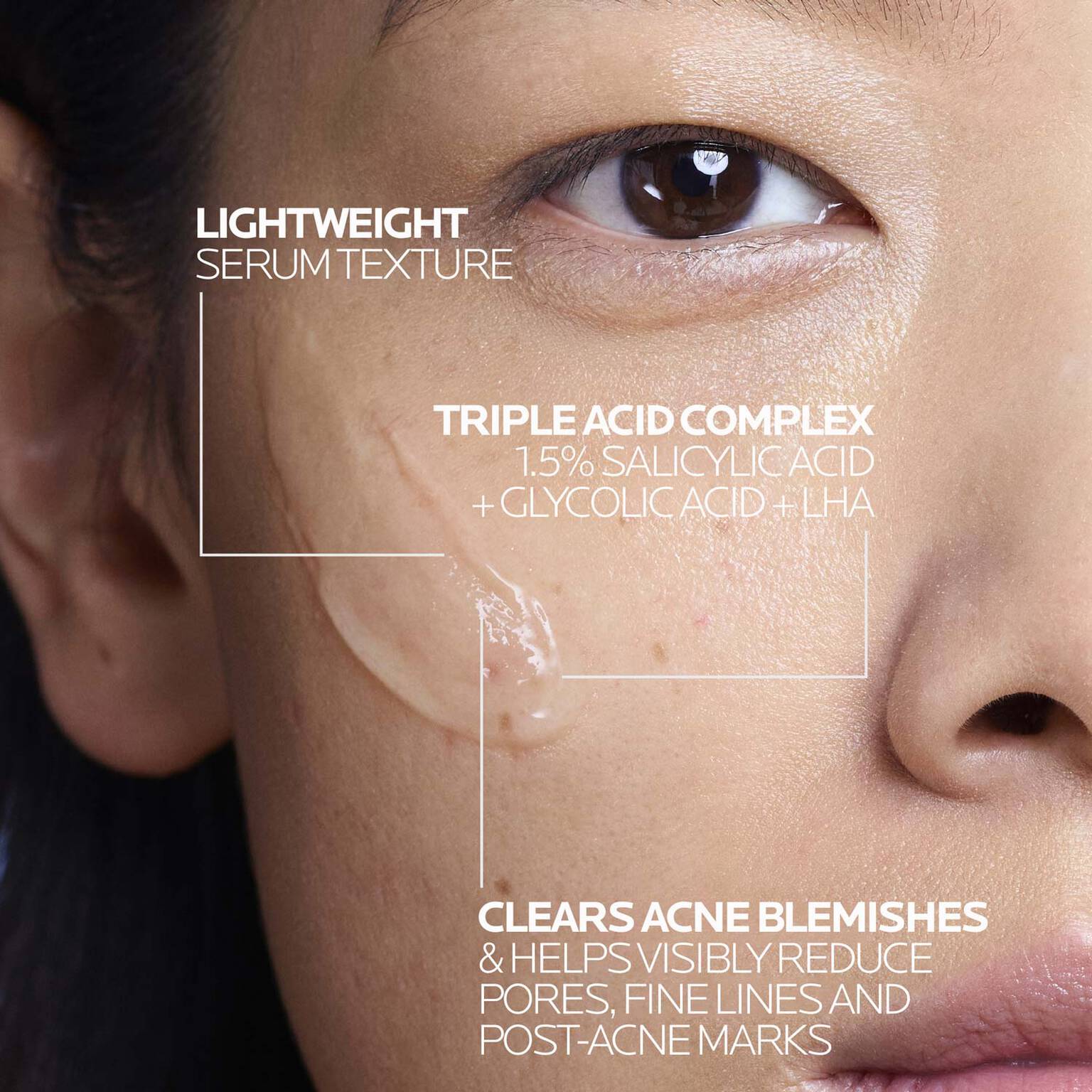 effaclar-salicylic-acid-acne-treatment-serum-v8 LaRochePosay-Product-Effaclar-Effaclar-Serum-30ml-3337875722827-Texture-REV.jpg