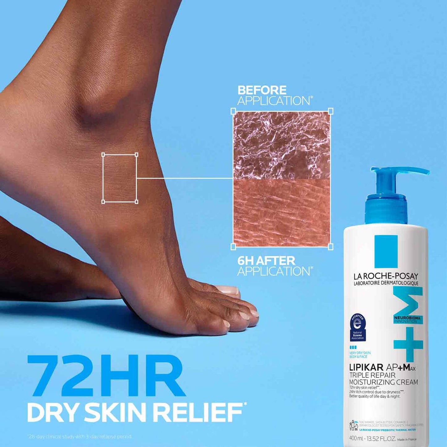 lipikar-ap-max-triple-repair-moisturizing-cream-z5 LaRochePosay-Product-Skincare-Lipikar-Balm-AP+MAX-400ml-3337875941150-ATF-PIM-BeforeAfter.jpg